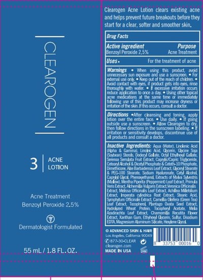 Acne Lotion Acne Treatment Bpo (Acne Lotion Acne Treatment Bpo.jpg)